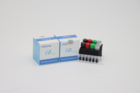 Yüksek Hassasiyetli HIV Real Time PCR Kiti POCT IVD Clinical Real Time PCR Teşhis Kitleri