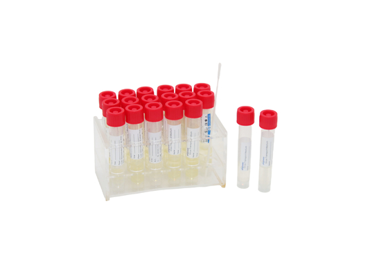 2 mL Tek Kullanımlık Virüs Örnekleme Kiti Tıbbi VTM Test Tüpü, Boğaz Çubuğu Çubuğu ile